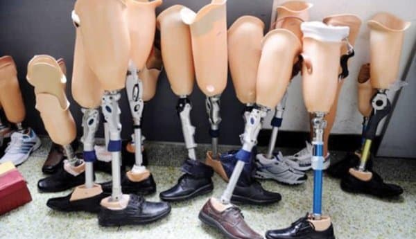 100,000 beneficiaries of prosthetic services in 2025